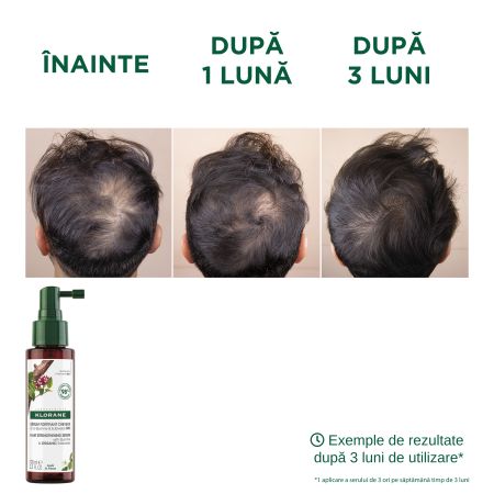 Serum impotriva caderii parului cu chinina si floare de colt bio, 100 ml, Klorane 723910