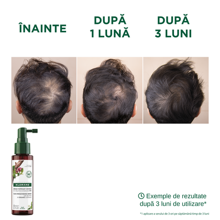 Serum impotriva caderii parului cu chinina si floare de colt bio, 100 ml, Klorane 723910