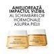 Crema de zi redensifianta cu efect de lifting pentru ten uscat Neovadiol Compensating Complex, 50 ml, Vichy 729738