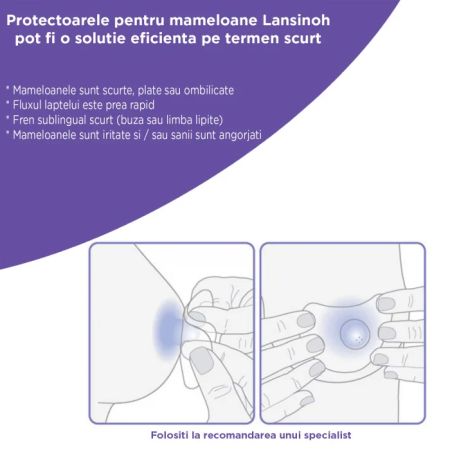 Protectoare mamelon, 24 mm, 2 bucati, Lansinoh 773187