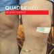 Plasturi piele sensibila Quadra Med, 2 marimi, 20 bucati, Master Aid 718900