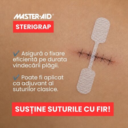 Plasture steril pentru suturarea ranii Sterigrap 32x8 mm, 10 bucati, Master-Aid 805447