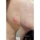 Serum pentru semne post-acneice cu AHA si BHA Postzit Acnemy, 30 ml, Niche Beauty 688648