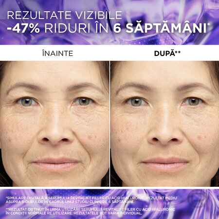 Ser antirid Revitalift Filler, 30 ml, Loreal Paris 757641