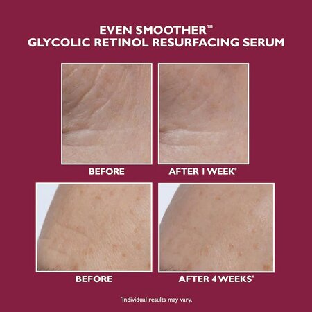 Ser de noapte pentru fata Even Smoother Glycolic Retinol Resurfacing, 30 ml, Peter Thomas Roth 559965