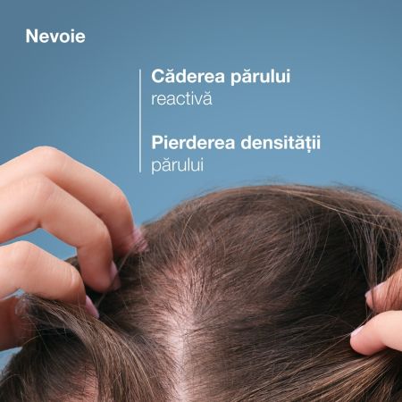 Lotiune impotriva caderii parului Anaphase Creastim, 60 ml, Ducray 715370